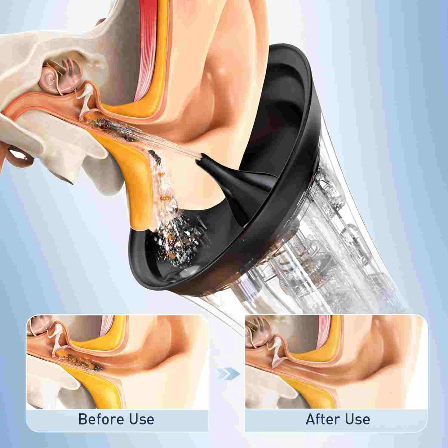 Safe Electric Water Spray Ear Wax Removal Kit for Instant Relief
